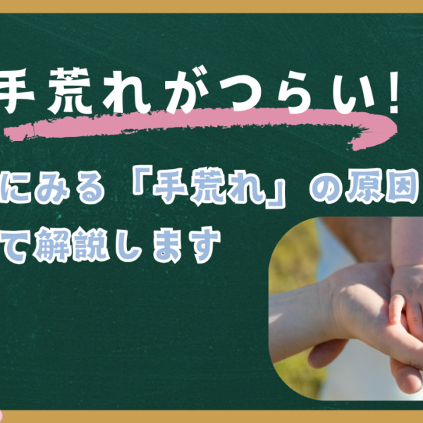【職業別に見る】手荒れの原因と対策